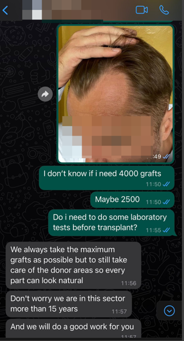 whatsapp 2 clinica di trapianto di capelli