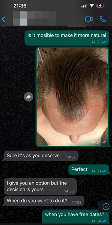 whatsapp clinica di trapianto di capelli 4