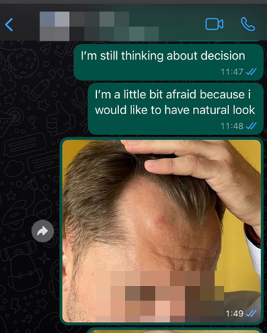 whatsapp clinica di trapianto di capelli 3