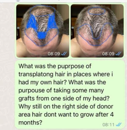 messaggio whatsapp clinica di trapianto di capelli 6